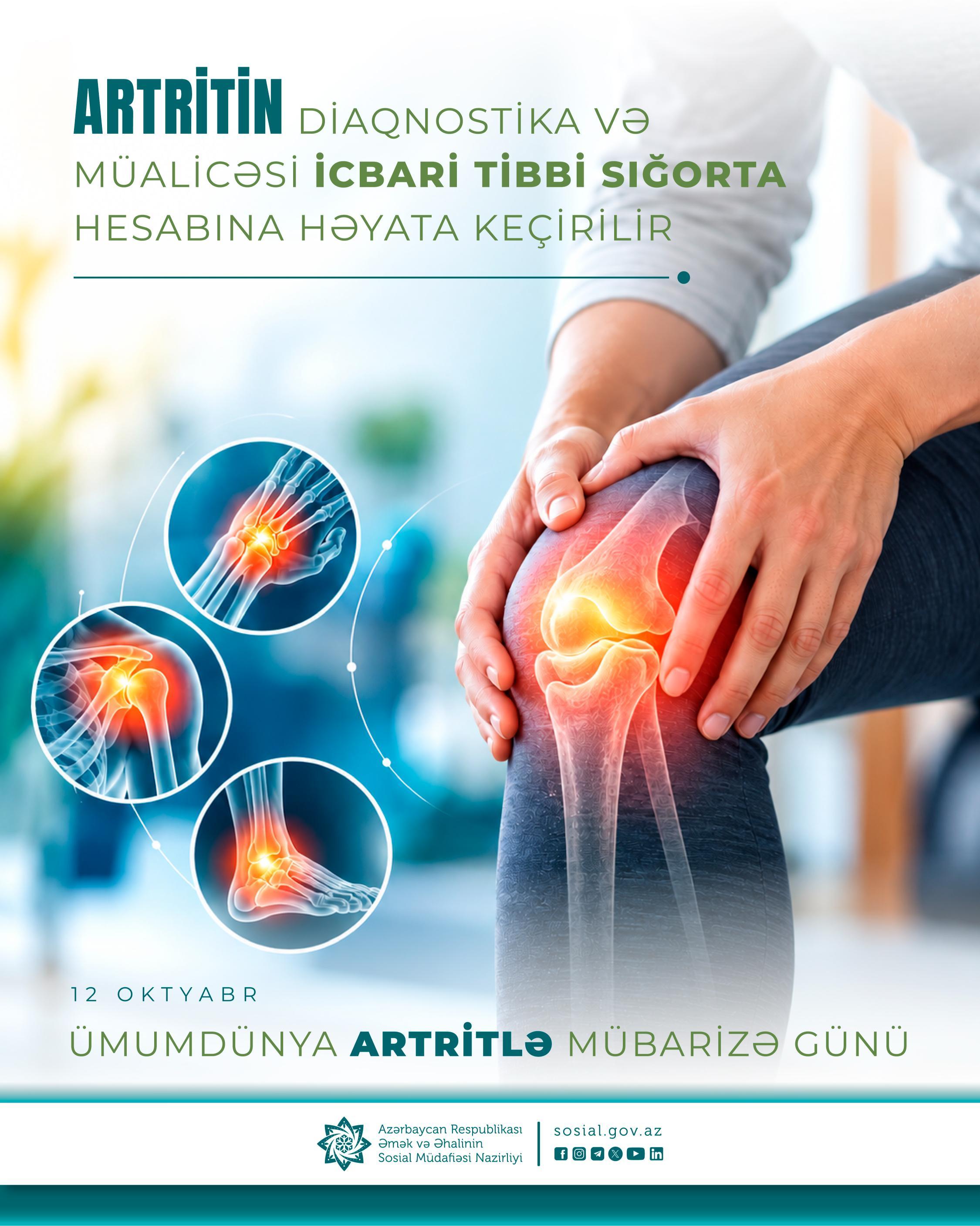 Artritin diaqnostika və müalicəsi icbari tibbi sığorta hesabına həyata keçirilir